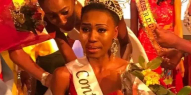 ملكة جمال الكونغو تتعايش مع فيروس نقص المناعة